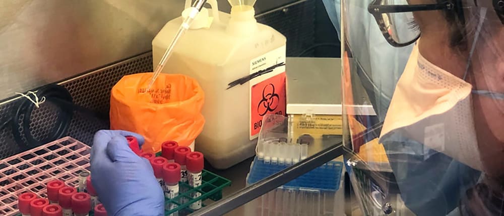 實(shí)驗(yàn)室里應(yīng)如何根據(jù)實(shí)際情況選擇個(gè)人防護(hù)裝備